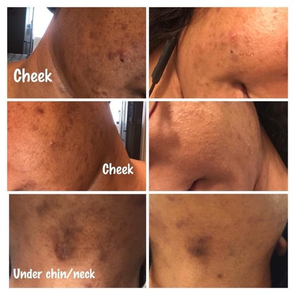 The healing herbal remedy Tea and pills - Picture 2 of 2